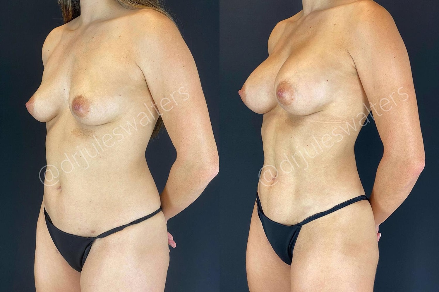 Before and after body transformation images.