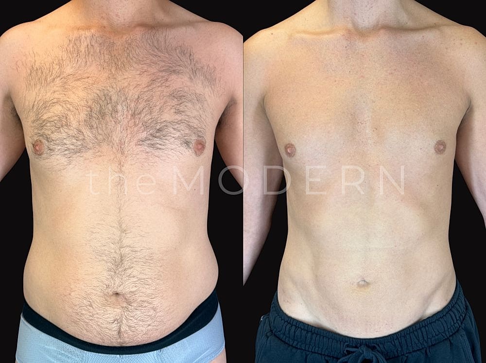 Before and after body transformation image.