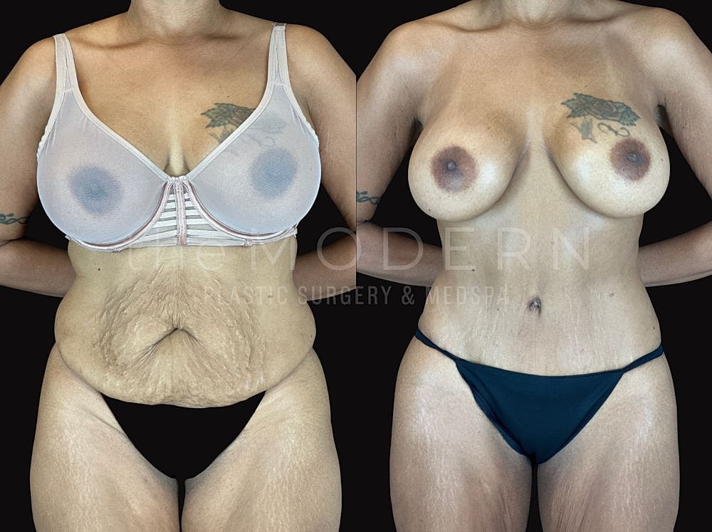 Before and after body transformation photos.