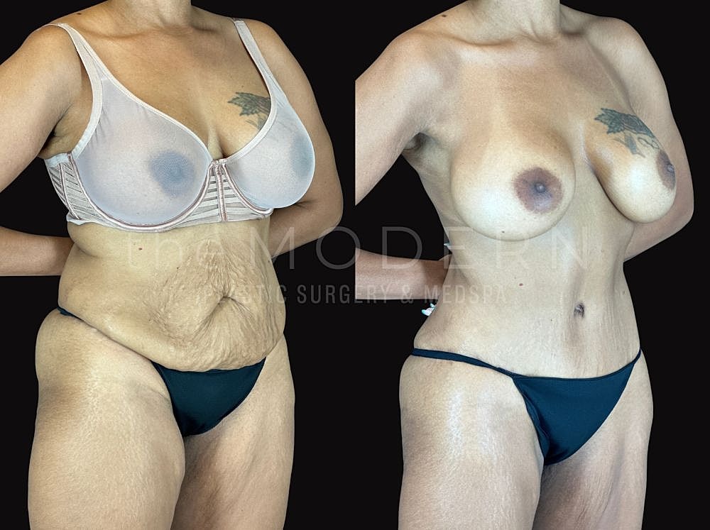 Before and after body transformation images.