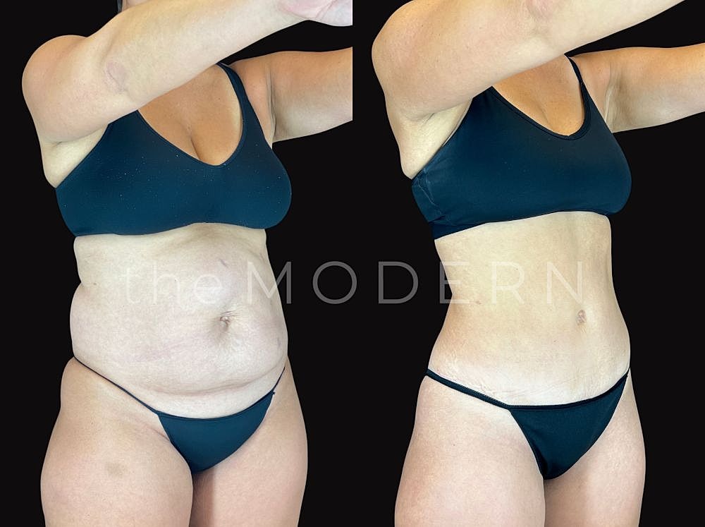 Body transformation before and after images.