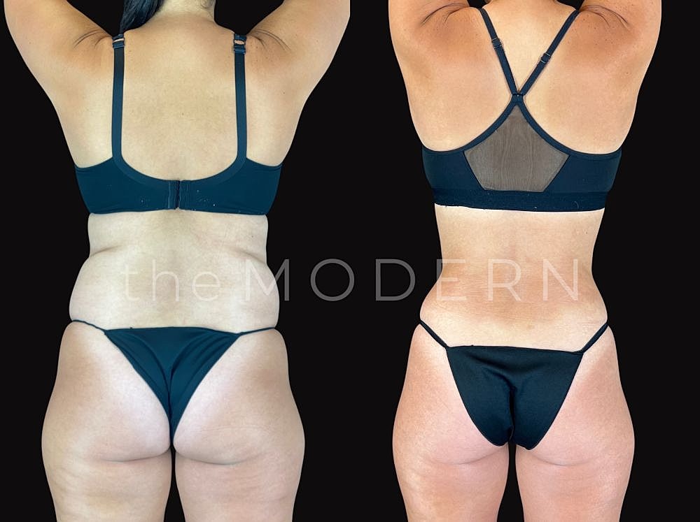 Before and after body transformation comparison.