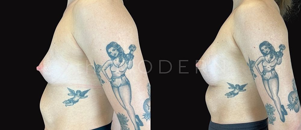Side profile of a tattooed person before and after.