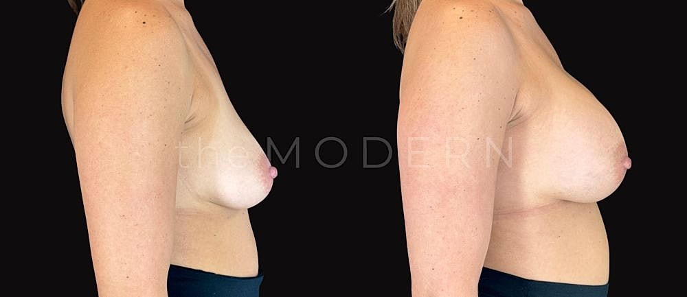 Before and after body transformation comparison.