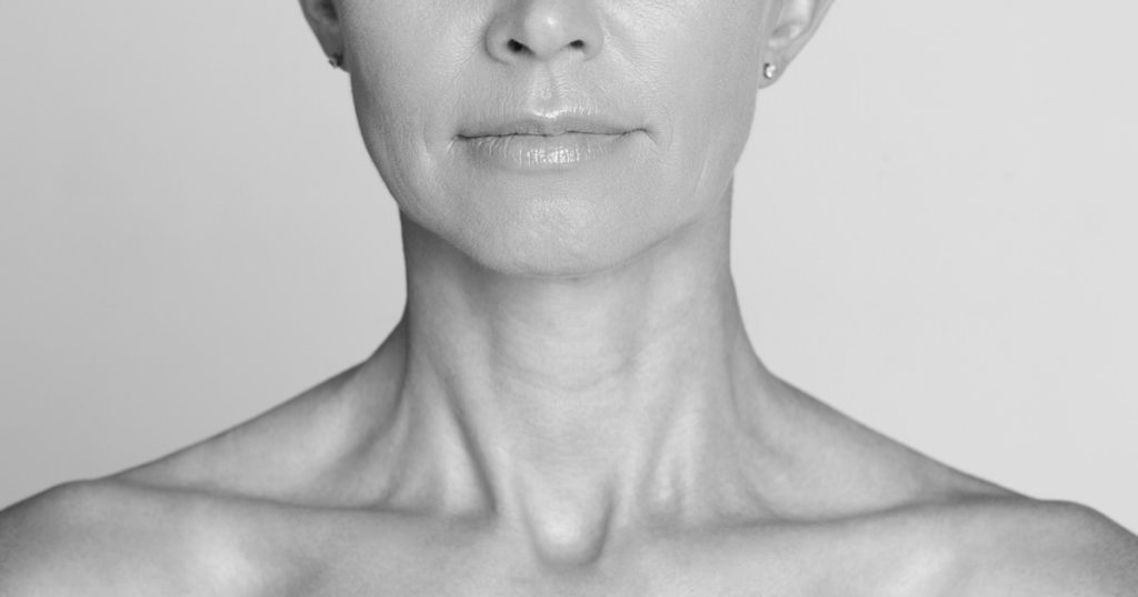 woman with wrinkled neck